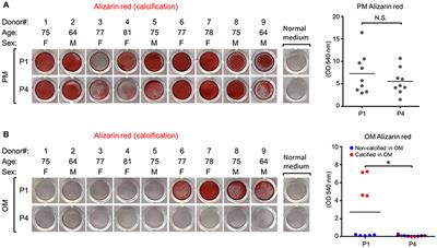 Standardization of Human Calcific Aortic Valve Disease in vitro Modeling Reveals Passage-Dependent Calcification